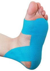 Plantar Fasciitis Taping