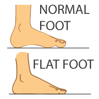 Orthotics and Arch Support Orthotics and Arch Support