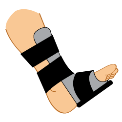 Night Splint More Harm Than Good