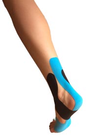 Plantar Fasciitis Taping